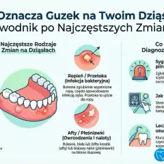 Nadziąślak to guzek zapalno-rozrostowy na dziąśle, często czerwony, który może krwawić.