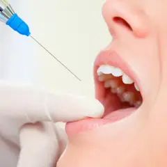 Bezbolesny dentysta? Znieczulenie w stomatologii: metody i bezpieczeństwo