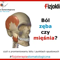 Model czaszki z zaznaczonym mięśniem skroniowym. Czy ból zęba może promieniować na inne zęby? #fizjoterapiastomatologiczna