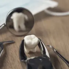 Ból po wyrwaniu zęba: Jak długo trwa i kiedy iść do dentysty?