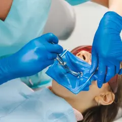 Dentysta zakłada koferdam, izolując pole zabiegowe.