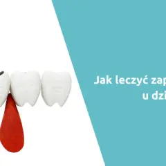 Zapalenie dziąseł u dziecka: Ile trwa i jak szybko ulżyć maluchowi?