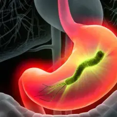 Objawy H. pylori w jamie ustnej: co mówi Twój oddech i język?