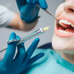 Czy znieczulenie u dentysty opóźnia okres? Prawda o stresie