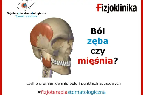Model czaszki z zaznaczonym mięśniem skroniowym. Czy ból zęba może promieniować na inne zęby? #fizjoterapiastomatologiczna