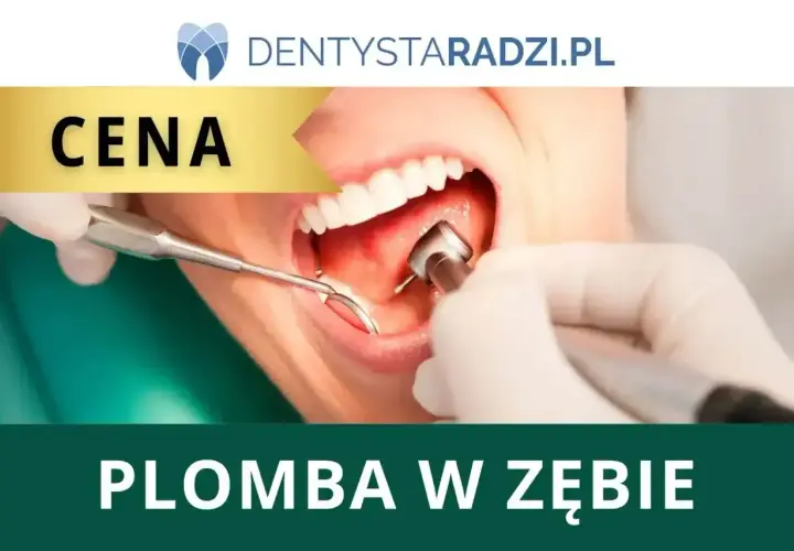Dentysta zakłada plomba chemoutwardzalna. Widoczne narzędzia stomatologiczne i usta pacjenta.