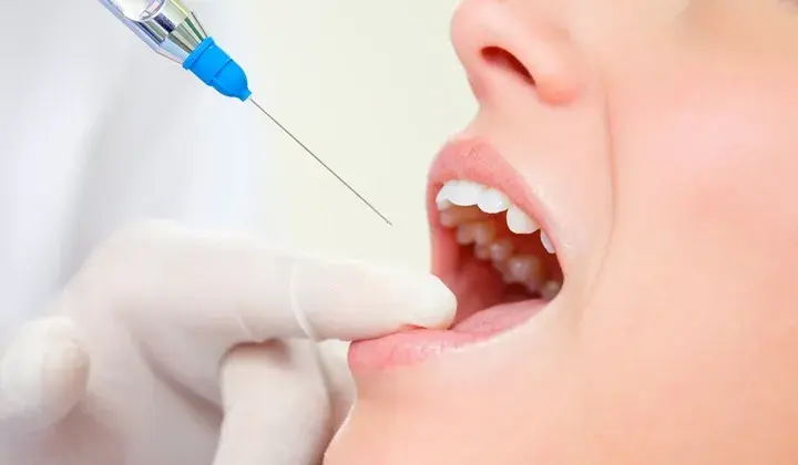 Bezbolesny dentysta? Znieczulenie w stomatologii: metody i bezpieczeństwo