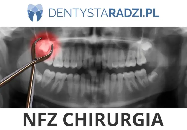 Rentgen zęba z kleszczami i czerwoną plamą bólu. Dowiedz się, ile kosztuje wyrwanie zęba w NFZ Chirurgia.