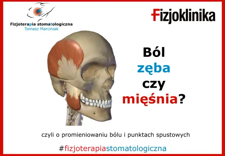 Model czaszki z zaznaczonym mięśniem skroniowym. Czy ból zęba może promieniować na inne zęby? #fizjoterapiastomatologiczna