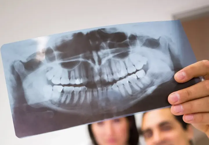 Lekarz analizuje panoramiczne badania radiograficzne szczęki, oceniając stan zębów i kości.