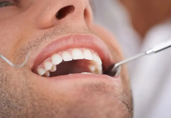 Ból zęba przed dentystą? Jakie leki są bezpieczne, a czego unikać?