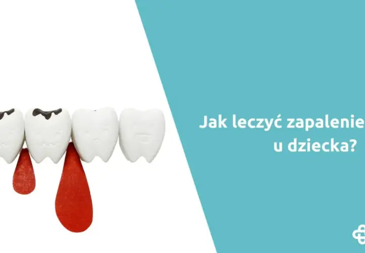 Zapalenie dziąseł u dziecka: Ile trwa i jak szybko ulżyć maluchowi?