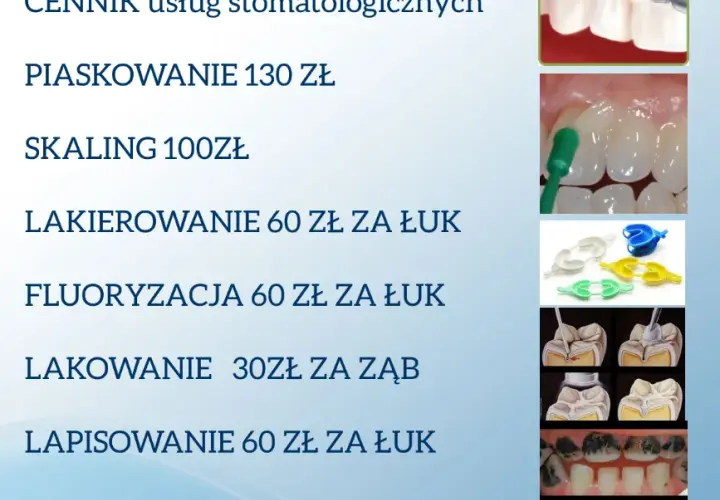 Koszt leczenia kanałowego zęba: Ceny, NFZ, na co uważać?
