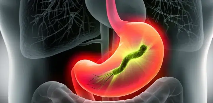 Objawy H. pylori w jamie ustnej: co mówi Twój oddech i język?