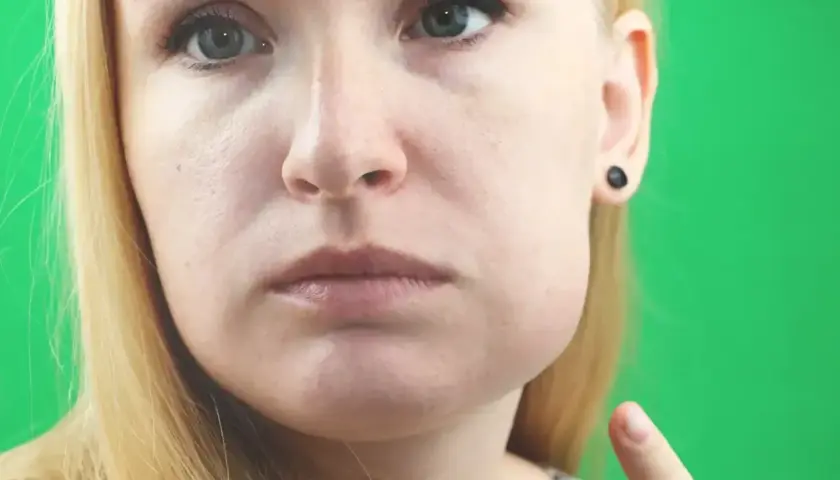 Kobieta z widocznym obrzękiem policzka, wskazującym na ropień zęba.