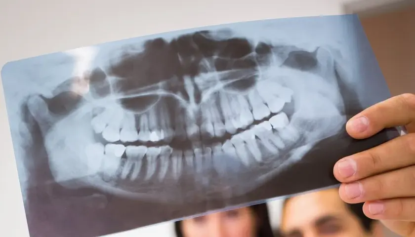 Lekarz analizuje panoramiczne badania radiograficzne szczęki, oceniając stan zębów i kości.