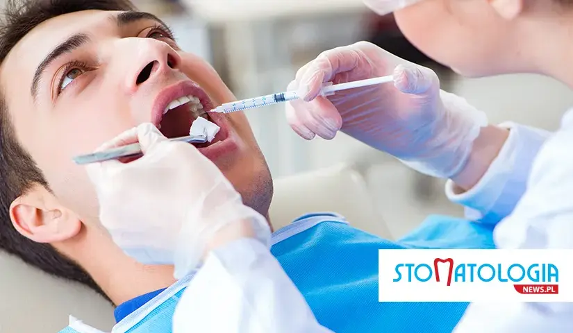 Znieczulenie u dentysty: bez bólu i strachu? Przewodnik eksperta