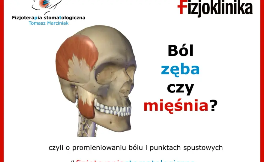 Czy ból zęba może promieniować na inne zęby?