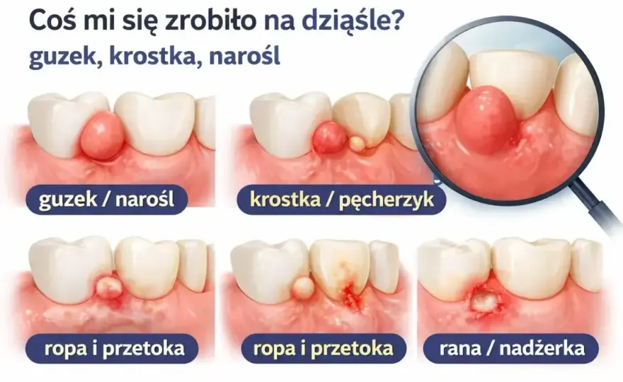 Chore zęby - jak rozpoznać problem i kiedy iść do dentysty?
