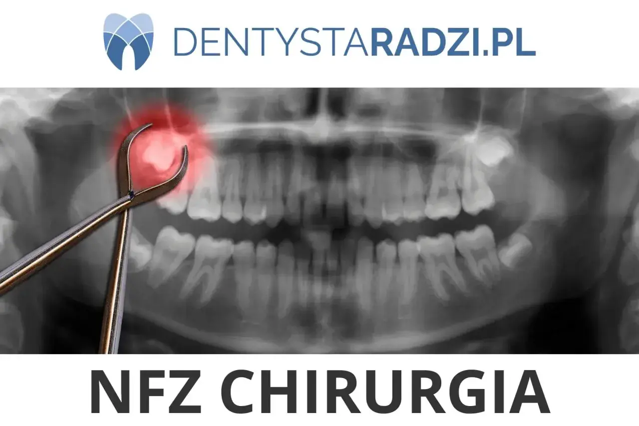 Rentgen zęba z kleszczami i czerwoną plamą bólu. Dowiedz się, ile kosztuje wyrwanie zęba w NFZ Chirurgia.