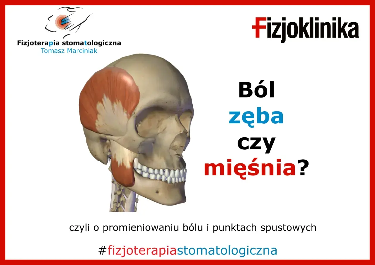 Model czaszki z zaznaczonym mięśniem skroniowym. Czy ból zęba może promieniować na inne zęby? #fizjoterapiastomatologiczna