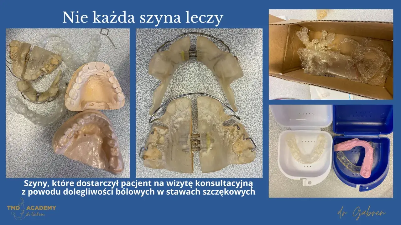 Szyny na zęby, modele szczęk i pudełka na ochraniacze. Pacjent przyniósł je z powodu bólu, co pokazuje, że bruksizm co to za problem, wymaga właściwego leczenia.