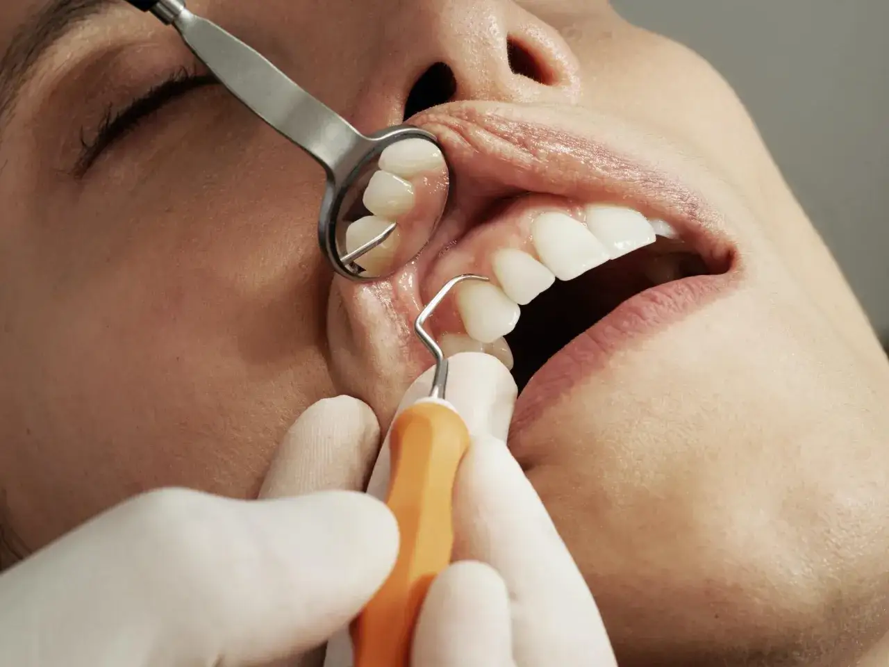 dentysta przegląd jamy ustnej