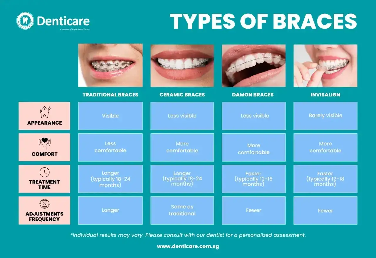 Porównanie aparatów: tradycyjny, ceramiczny, Damon i Invisalign. Invisalign to dyskretny, przezroczysty clear aligner.