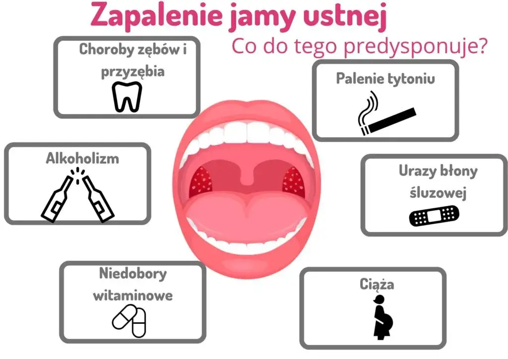 Objawy stanu zapalnego jamy ustnej