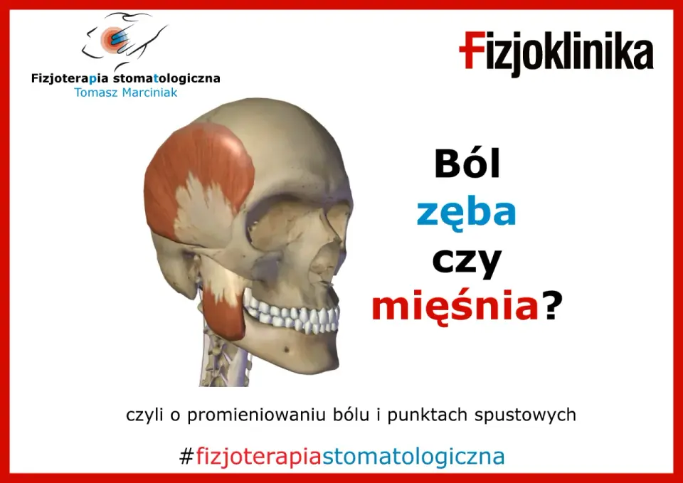 Czy ból zęba może promieniować na inne zęby?